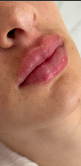 Depois da harmonização